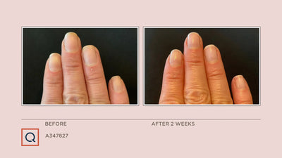 Adesse New York Intensive Nail Defense Trio